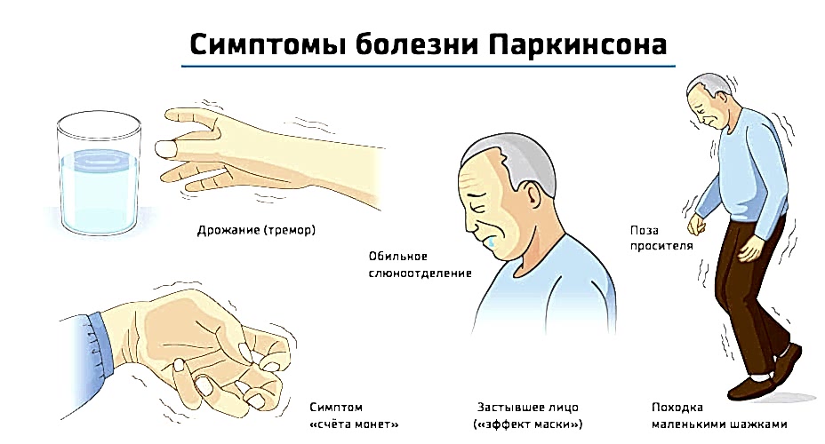 симптомы болезнь Паркинсона