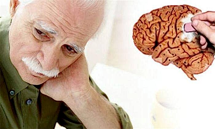 ухудшение памяти