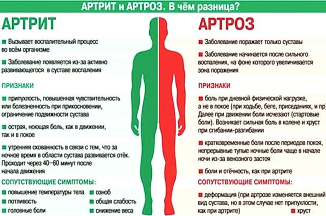артрит и артроз отличия